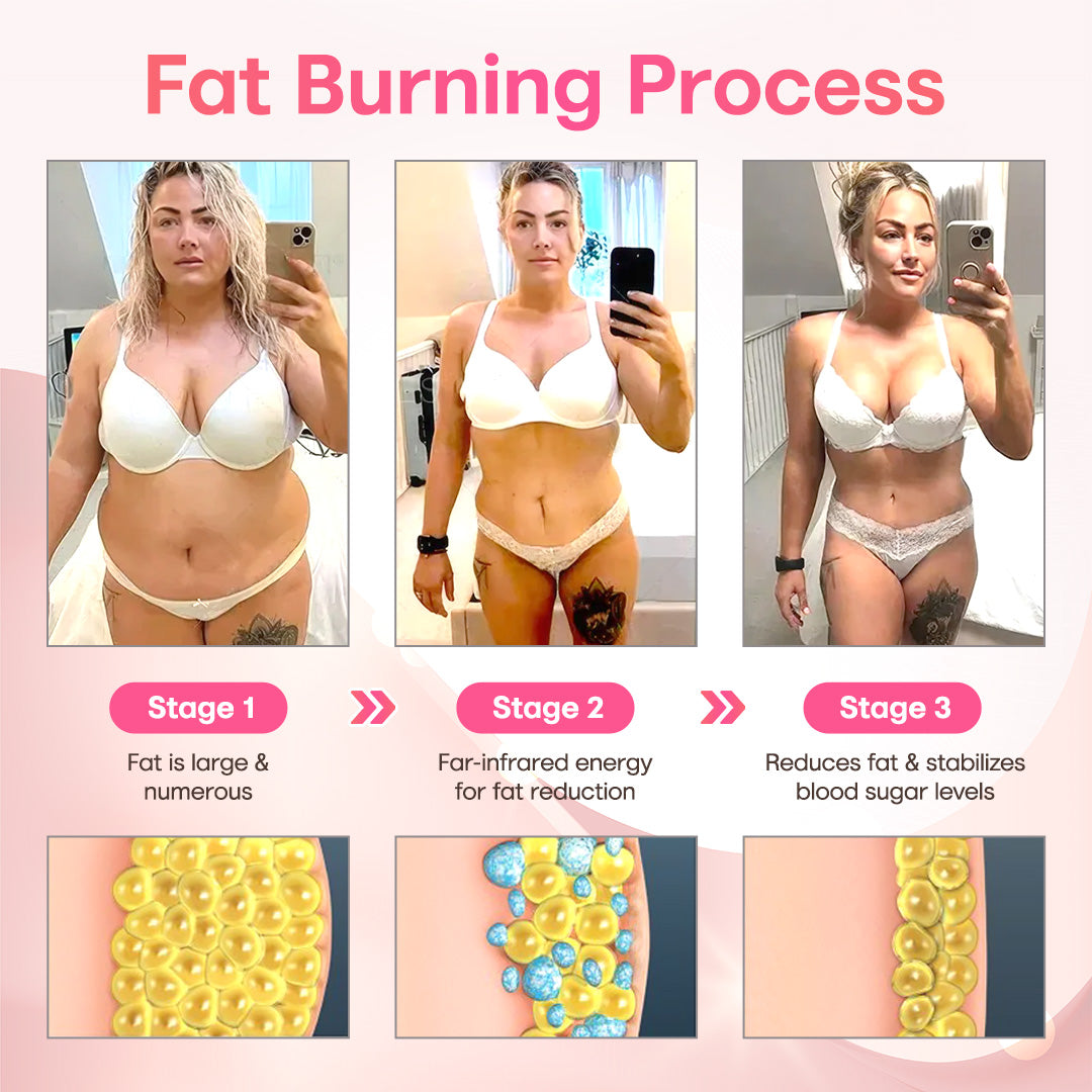 ✨[OFFICIAL STORE]  ODEIUN™ Ion Shaping Shorts – Slim & Tone with Tourmaline-Infused Fabric! ✅ Breathable & Compression ✅ Boosts Circulation ✅ Quick Results – Feel the Difference Instantly